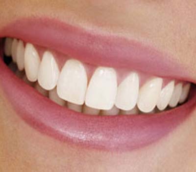 صحت مند ،صاف اور چمکتے دانتوں کیلئے چھوٹے چھوٹے نسخے